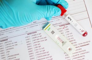 Важность сдачи анализа на бета-ХГЧ Важность сдачи анализа на бета-ХГЧ