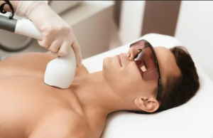 Лазерная эпиляция и ее особенности